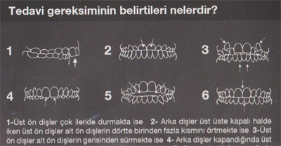 ORT4